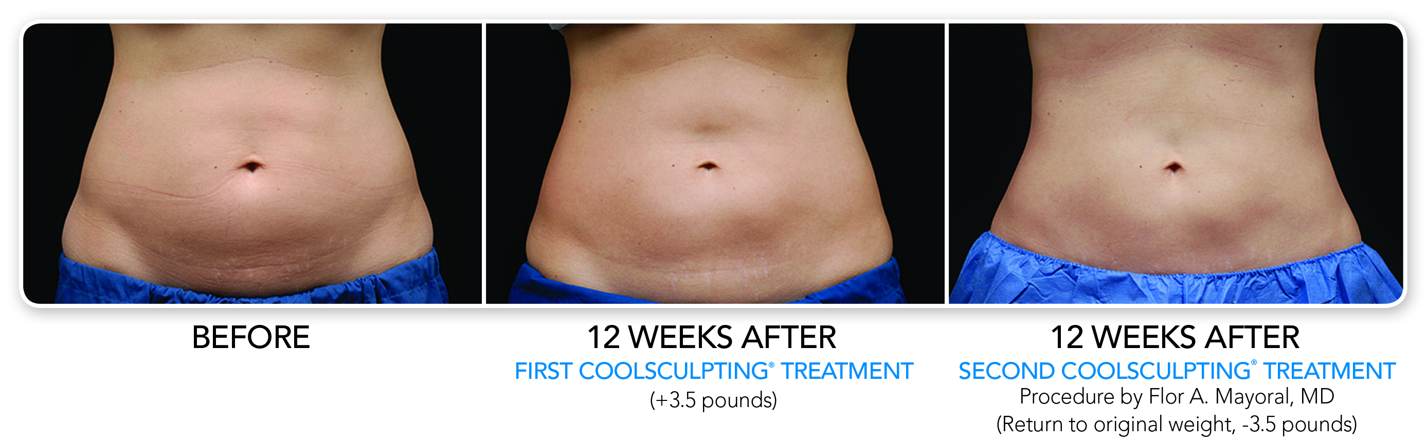 Body Contouring Washington DC Dermatologist MI Skin