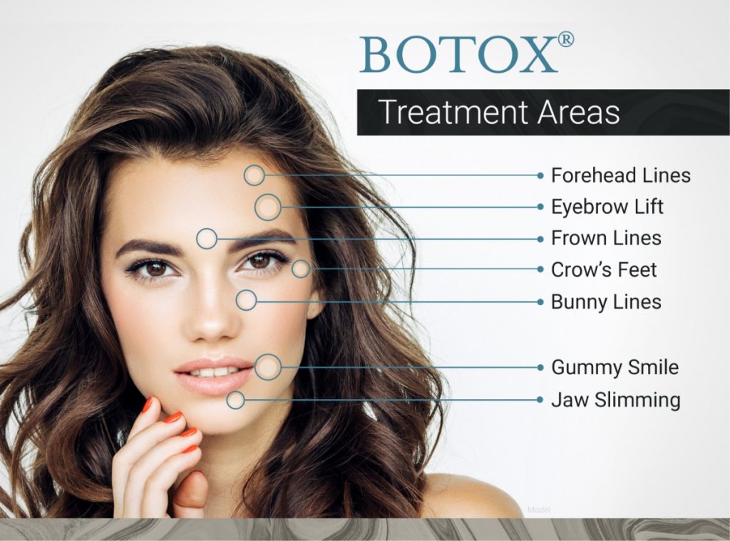 BOTOX treatment area graphic