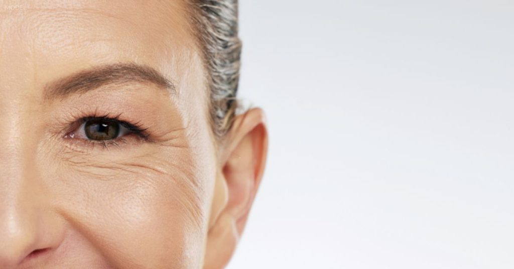 Close up of a woman's eyebrow after a botox brow lift. (Model)