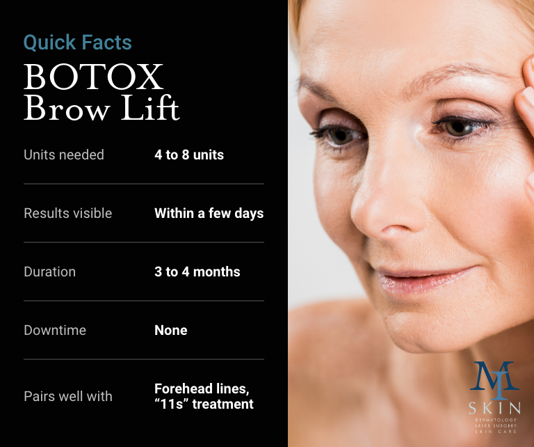 Infographic from MI Skin Dermatology on quick facts on BOTOX brow lift. Including how many units needed, how long until you can see results, how long it lasts, downtime, and any additional treatment that might pair well with it.